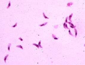 toxoplas.jpg (6203 bytes)